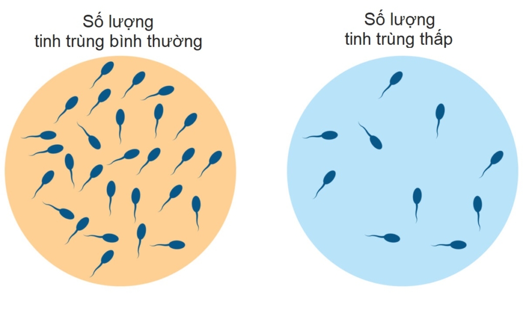 COVID-19 có liên quan đến suy giảm chất lượng tinh trùng; Cách duy trì số lượng tinh trùng khỏe mạnh