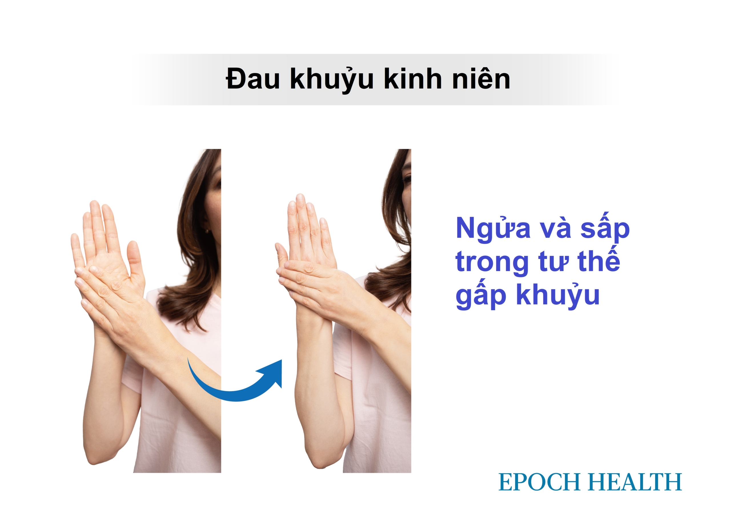 Đau khuỷu tay kinh niên: Thường do yếu cơ - 6 bài tập đơn giản giúp giảm đau