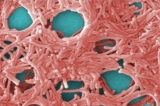 CDC cảnh báo về sự gia tăng các đợt bùng phát căn bệnh chết người do vi khuẩn có trong nước máy