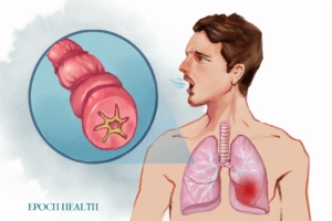 Hướng dẫn cơ bản về bệnh hen suyễn: Triệu chứng, nguyên nhân, điều trị và các cách tiếp cận tự nhiên