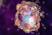 Ảnh minh họa cơ chế apoptosis của tế bào. Ferroptosis khác với apoptosis. (Ảnh: best in world/Shutterstock)
