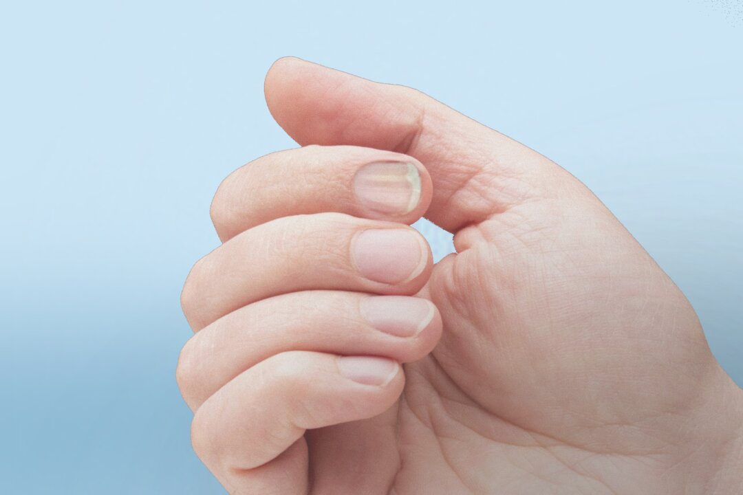Các thay đổi ở móng tay có thể liên quan đến bệnh ung thư