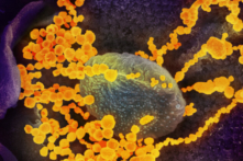 Kính hiển vi điện tử cho thấy hình ảnh của SARS-CoV-2 (vật thể tròn màu vàng), gây bệnh COVID-19, đang xuất hiện từ các tế bào nuôi cấy. (Ảnh: NIAID qua The Epoch Times)