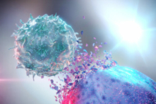 Ảnh: Tế bào diệt tự nhiên tiêu diệt một tế bào ung thư (Alpha Tauri 3D Graphics/Shutterstock)