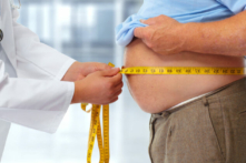 Hình ảnh bác sĩ đang đo vòng bụng cho người đàn ông béo phì. (Ảnh: grinny/Shutterstock)